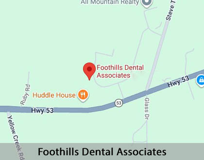 Map image for Options for Replacing Missing Teeth in Marble Hill, GA