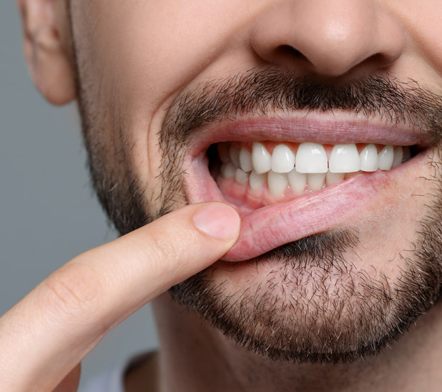 Marble Hill Why Are My Gums Bleeding